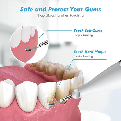 HexoSmile™ Ultrasonic Dental Cleaner for Tartar Removal & Teeth Whitening