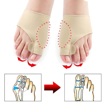HexoBunion™ - Orthopedic Corrector Sleeve (1 pair)