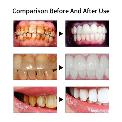 HexoTeeth™ Ultrasonic Tooth Cleaner